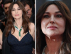 Акне, разширени пори, бръчки: Как изглеждат лицата на най-красивите известни дами отблизо (СНИМКИ)